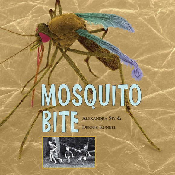 Mosquito Bite </br>Item: 915925